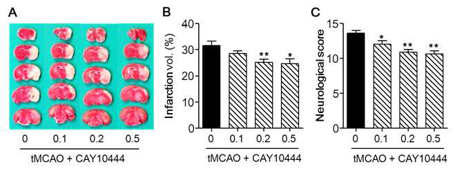CAY10444를 활용한 허혈성뇌졸중의 뇌손상과 S1P3 활성화의 상관성 규명