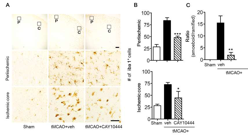CAY10444를 활용한 허혈성뇌졸중에서 미세아교세포 활성화와 S1P3 활성화의 상관성 규명