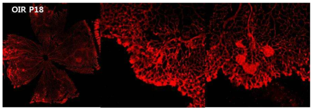 Sprague-Dawley rat을 이용한 Oxygen induced retinopathy (OIR) 모델의 제작. 망막 주변부의 신생혈관 증식이 관찰됨. 제작한 모델 대부분에서 3quadrant 이상의 신생 혈관 증식을 보임. 이러한 신생혈관은 미숙아망막병증의 stage 3인 extraretinal fibrovascular proliferation과 매우 유사한 소견임