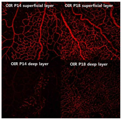 Sprague-Dawley rat을 이용한 Oxygen induced retinopathy (OIR) 모델의 망막 혈관 염색 사진. P14에는 망막 혈관이 퇴행하며 무혈관 부위가 발생하고 deep vascular plexus의 발달이 적은 반면 P18에는 무혈관 부위가 감소하고 deep vascular plexus의 발달이 나타남. P18에는 망막 혈관의 구불거림 현상이 관찰됨. 망막 혈관의 구불거림은 미숙아망막병증의 주요 치료 지표인 plus sign과 유사한 변화임