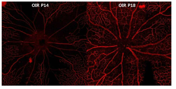 고농도 산소에 의해 망막 혈관의 퇴행이 발생해 넓은 무혈관 부위가 보이는 P14 망막 중심부의 혈관 사진과 이후 다시 혈관 재형성이 나타난 P18 망막 중심부 사진