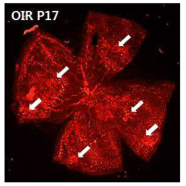 C57BL/6 mouse를 이용한 Oxygen induced retinopathy (OIR) 모델의 제작. 제작한 모델 대부분에서 3 quadrant 이상의 신생 혈관 증식을 보임. 이러한 신생혈관은 미숙아망막병증의 stage 3인 extraretinal fibrovascular proliferation과 매우 유사한 양상을 보임