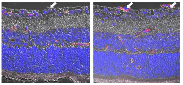 C57BL/6 mouse를 이용한 Oxygen induced retinopathy (OIR) 모델의 망막 혈관 단면 염색 사진. 망막 표면에 신생혈관이 관찰됨 (red, arrows)