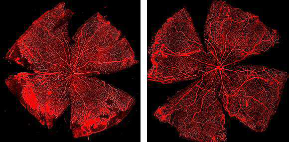 Rat OIR P14에 1X106 개의 세포부유액 혹은 배양액을 복강 내 주사. P18에 적출 후 염색한 망막 혈관 사진 (좌: media only injection, 우: hMSC injection). 세포배양액만 주사한 군에 비해 MSC를 주사한 군에서 높은 신생혈관 억제효과를 보임