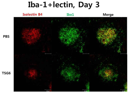 TSG-6 안구 내 주사 후 혈관 염색위한 isolectin 및 macrophage marker인 Iba1을 함께 형광 염색한 후 confocal 현미경으로 촬영함. TSG-6를 주사한 군에서 신생혈관 감소 및 Iba1+ 염증 세포의 침윤 감소가 확인됨