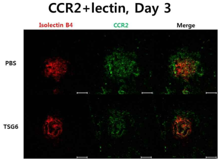 TSG-6 안구 내 주사 후 혈관 염색위한 isolectin 및 infiltrating monocyte marker인 CCR2를 함께 형광 염색한 후 confocal 현미경으로 촬영함. TSG-6를 주사한 군에서 CCR2+ 세포의 침윤 감소가 확인됨