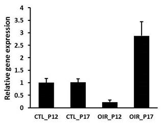 Mouse OIR과 대조군을 각 P12, P17에 적출 한 후 GREM-1 quantitative RT-PCR을 진행. 그 결과 OIR P12와 P17에 나타나는 유전자 발현 정도에 차이가 있었으며, 이는 실제 동물모델이 만들어 지는 과정 중의 혈관신생 정도와 일치함