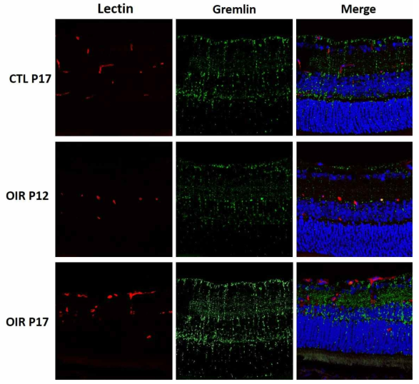 OIR 망막 조직에서 면역조직화학염색을 시행함. 신생혈관(Red)의 생성을 확인하기 위해 lectin과 함께 진행하였으며 GREM-1(Green)은 일반적으로 나타나는 Müller cell과 비슷한 발현 양상을 보였으며 특히 P17에서 발현정도가 증가하였음