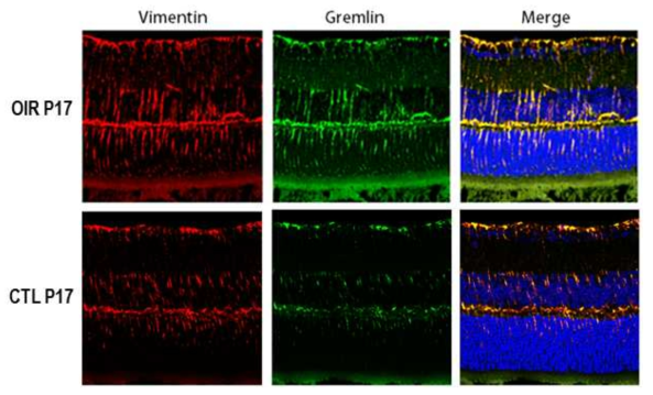 OIR P17 망막 조직에서 Müller cell marker인 vimentin과 함께 Gremlin의 면역조직 화학염색을 동시에 시행함. OIR P17에서 vimentin의 발현이 증가해 Müller cell gliosis가 발생함을 알 수 있음