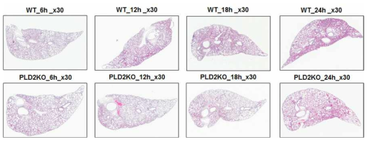 PLD2 결핍이 CLP 패혈증 모델에서 폐 손상에 미치는 영향