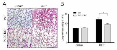 PLD2 결핍이 CLP 패혈증 모델에서 폐 손상 및 폐부종에 미치는 영향