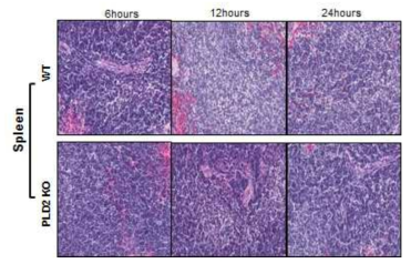 PLD2 결핍이 CLP 패혈증 모델에서 spleen 손상에 미치는 영향