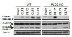 PLD2 결핍이 CLP 패혈증 모델에서 splenocytes의 사멸에 미치는 영향