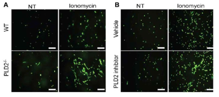 Neurophil extracellular trap (NET) 형성에 PLD2가 미치는 영향