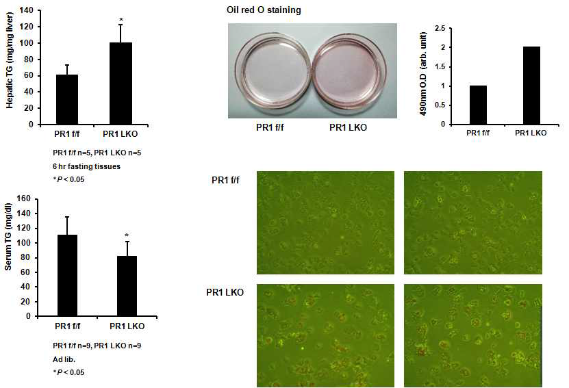 PRMT1의 liver KO에 의한 TG level의 변화를 생쥐 및 primary hepatocytes에서 검증함