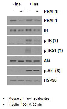 PRMT1 knockdown된 primary hepatocytes에서 인슐린 처리 후, IR, IRS-1, Akt의 인산화 변화 정도를 western blot analysis를 통하여 확인함
