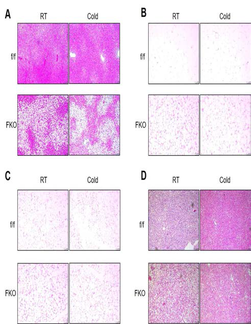 PRMT1 FKO mouse의 histology 분석 A-D. PRMT1 FKO mouse와 WT mouse를 HFD feeding 후 정상 온도 (RT)와 4°C에서의 histology 분석을 간 조직 (A), visceral white adipocytes (B), subcutaneous white adipocytes (C), brown adipocytes (D)에서 수행함