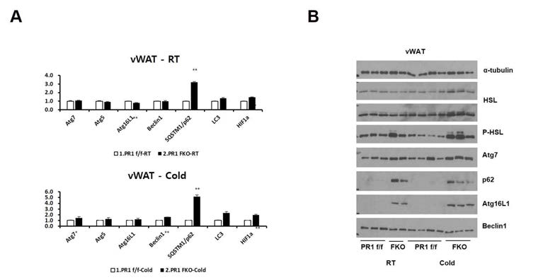 PRMT1 FKO mouse의 백색지방 표현형 분석 A. PRMT1 FKO mouse의 백색지방 (visceral fat)의 autophagy 관련 타겟 유전자의 발현을 정상 온도와 4°C 조건에서 비교함. B. PRMT1 FKO mouse의 백색지방 (visceral fat)의 autophagy 관련 타겟 단백질의 발현을 정상 온도와 4°C 조건에서 비교함