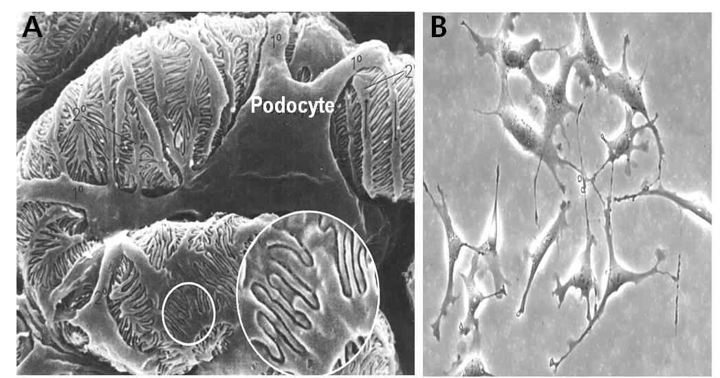 (A) in vivo rat glomerulus scanning EM: 전형적 족세포의 foot process와 SD를 형성함 (B) conditionally immortalized podocyte: 분화가 완료되어 primary process를 형성하지만 foot process를 만들지 못하며 세포 간의 slit diaphragm을 형성 못함