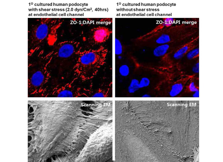 사구체여과장벽 모사 dual-channel prototype chip device에서 내피세포 측 channel에 Harvard syringe pump를 이용하여 laminar flow shear stress 유발한 이후 족세포의 confocal (A) 및 scanning EM image (B). 내피세포에 shear stress를 유발한 경우 족세포의 ZO-1이 cell junction을 따라 발현함이 관찰되고 일부 SEM에서 tight juction과 같은 모양을 확인함