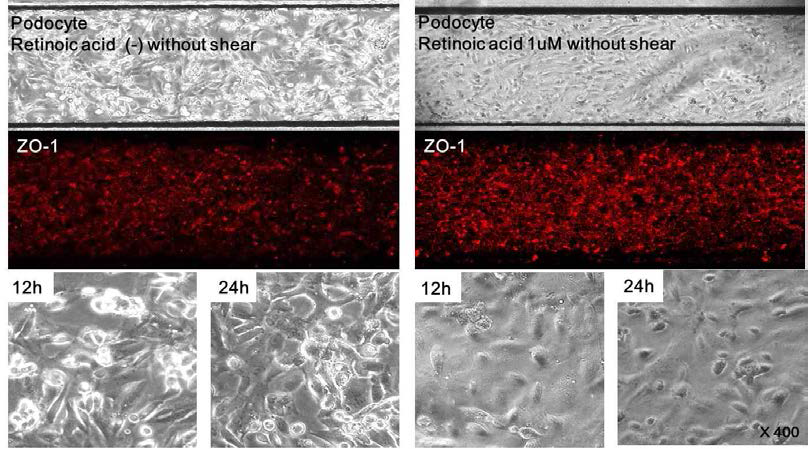 chip 내 podocyte의 attachment 불안정성이 있었으나 endothelial cell chamber에 laminar shear stress를 주기 이전에 retinoic acid 처리 후 podocyte cell attachment가 적절히 발생함을 확인함. 동시에 ZO-1의 발현도 증가함을 확인함