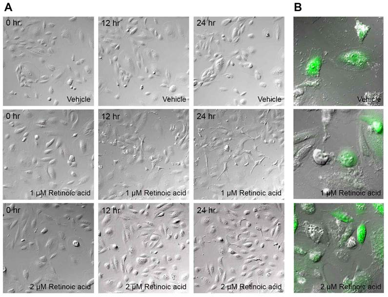 (A) 정적 배양 환경에서 KLF15의 활성화를 유도하는 retinoic acid의 처리시 초대 배양 과정 중 탈분화된 족세포가 arborized cell shape을 보여 분화의 가능성을 보임. (B) 정적 배양 환경에서 retinoic acid의 처리 시 초대 배양된 족세포의 mobility 증가와 cell-to-cell contact의 증가를 보임 (Live image for 3 days, 파일첨부)