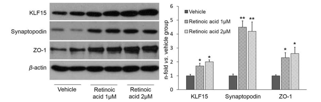 정적 배양 족세포에서 retinoic acid (vehicle, 1 μM 또는 2 μM) 48시간 자극 후 KLF15, ZO-1, synaptopodin 단백의 Western blot 및 densitometric quantification (*p<0.05 vs.vehicle group; ** p<0.001 vs. vehicle group)