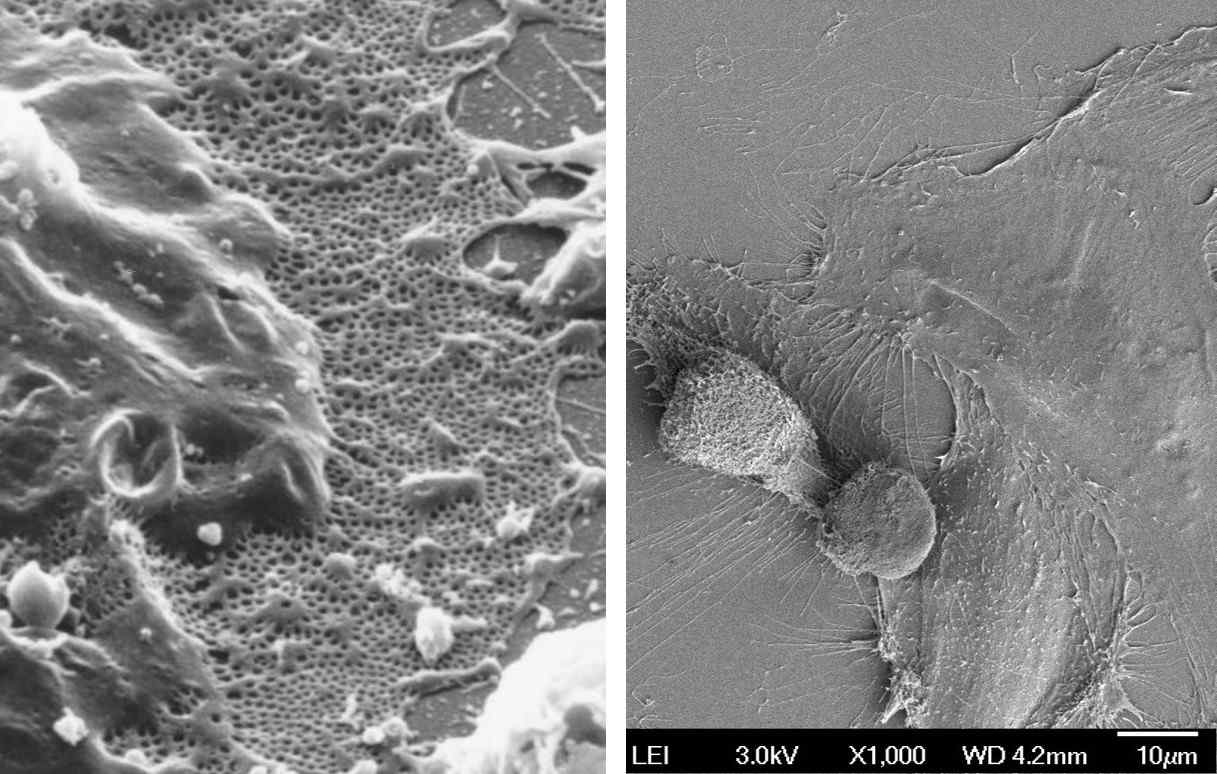 (좌) 정상적인 사구체 내피세포 (rat)의 fenestra, (우)chip에서 laminar shear stress 를 유발시킨 HUVEC의 scanning electron microscopy: 정상적인 사구체내피세포의 fenestra가 없음