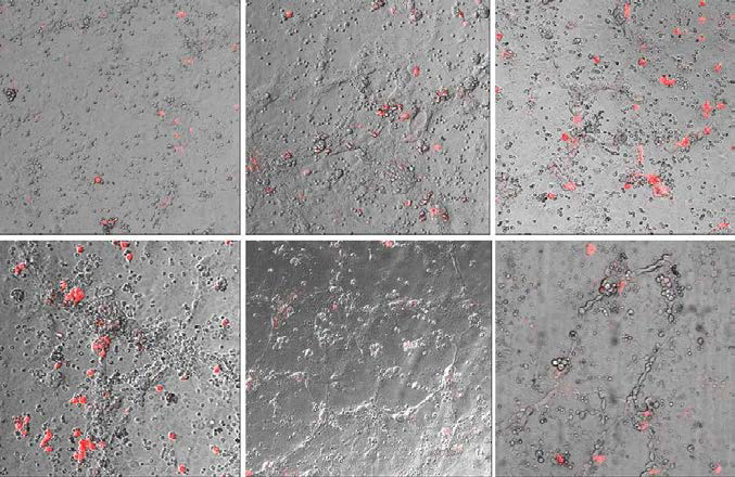 matrigel에 배양한 HUVEC에 red fluorescence tagging ADSC를 co-culture한 후 tube formation assay