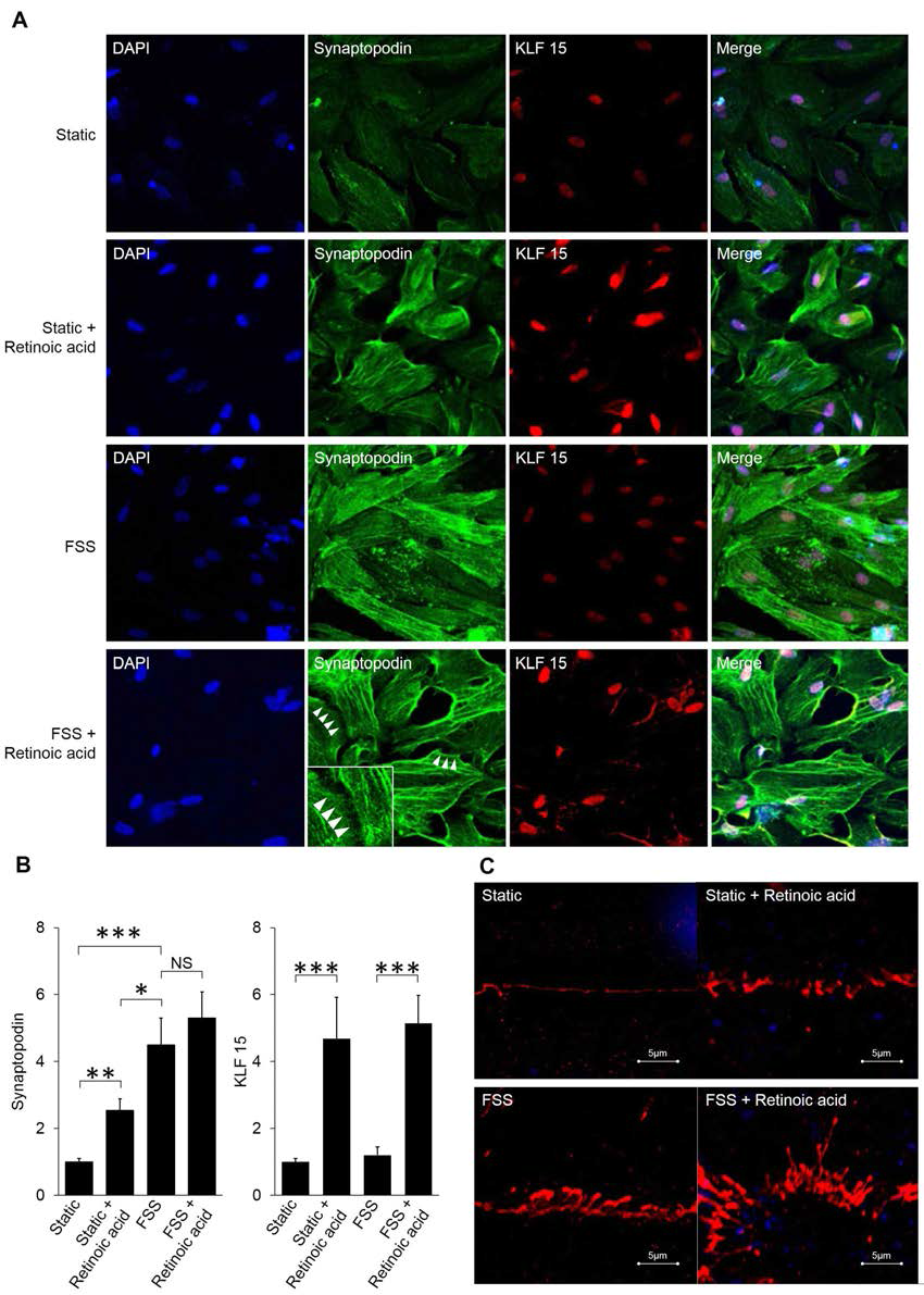 (A) static, static+RA, FSS, and FSS+RA 조건에 따른 족세포의 confocal microscopy images [DAPI (blue), synaptopodin (green) and KLF15 (red)] (Original magnification, x400; x800 [white box]; arrowhead, interdigitating cell processes). (B) 족세포의 synaptopodin 및 KLF15 상대적 fluorescence signal intensity (*P < 0.05; **P < 0.01; ***P < 0.005; NS, no significance). (C) super-resolution microscopy를 이용한 족세포의 ZO-1 발현 (Original magnification, x3000; scale bar, 5 μm)