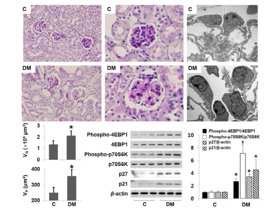 Control 및 STZ 유도 DBA/2J mice에서 control mice에 비하여 사구체 및 족세포의 volume 증가와 더불어 사구체 4EBP1 및 p70S6K의 phosphorylation 및 CDKi의 발현 증가를 확인함 (*P < 0.05; †P < 0.01)