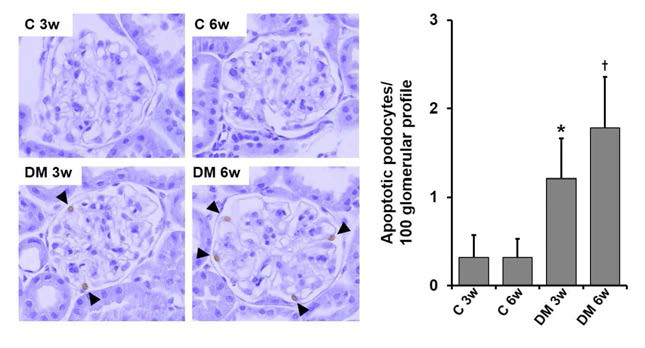 STZ 당뇨 유발 3주와 6주째 각각 control 과 비교한 TUNEL staining. 당뇨 유발 mice에서 유의하게 apoptotic cell의 증가가 있음을 확인함