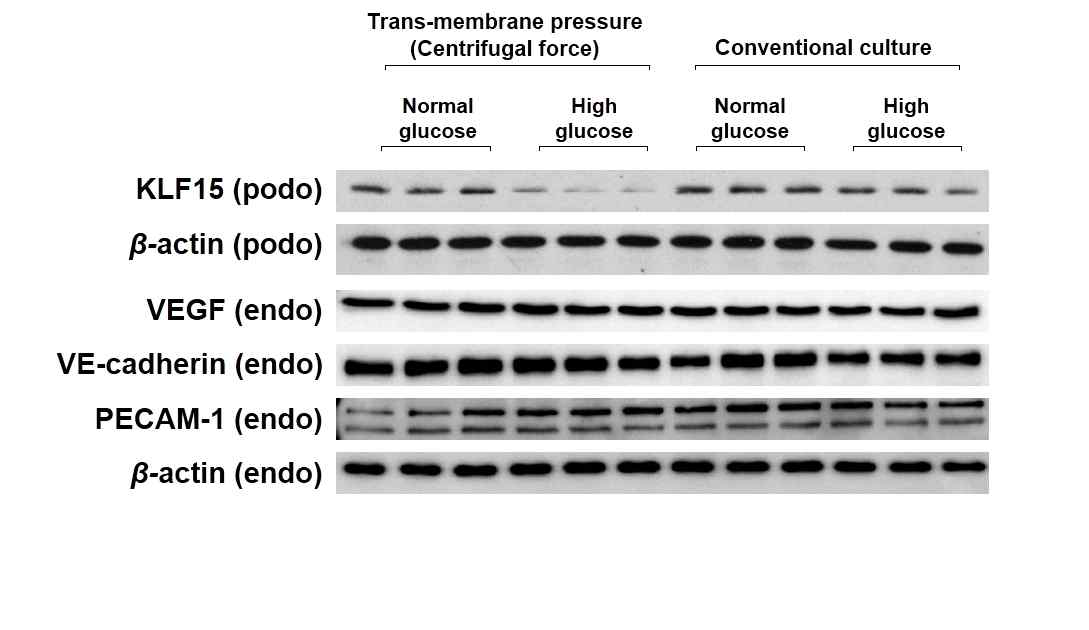 centrifugal force를 이용하여 glomerular hyperfiltration을 모사함. 당뇨조건에서 centrifugal force로 trans-membrane pressure 를 유발하였을 때 고포도당조건에서 족세포 KLF15발현 감소 확인