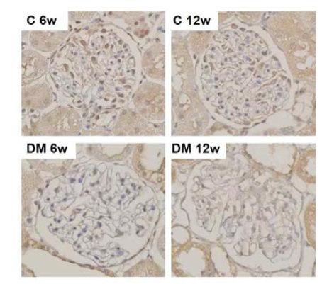 STZ로 유도한 당뇨 DBA/2J mice (6w, 12w after STZ)과 control mice에서 KLF15의 발현. Control mice에서 DAB 발색이 주로 족세포에서 나타나며 DM mice에서 발현이 감소함