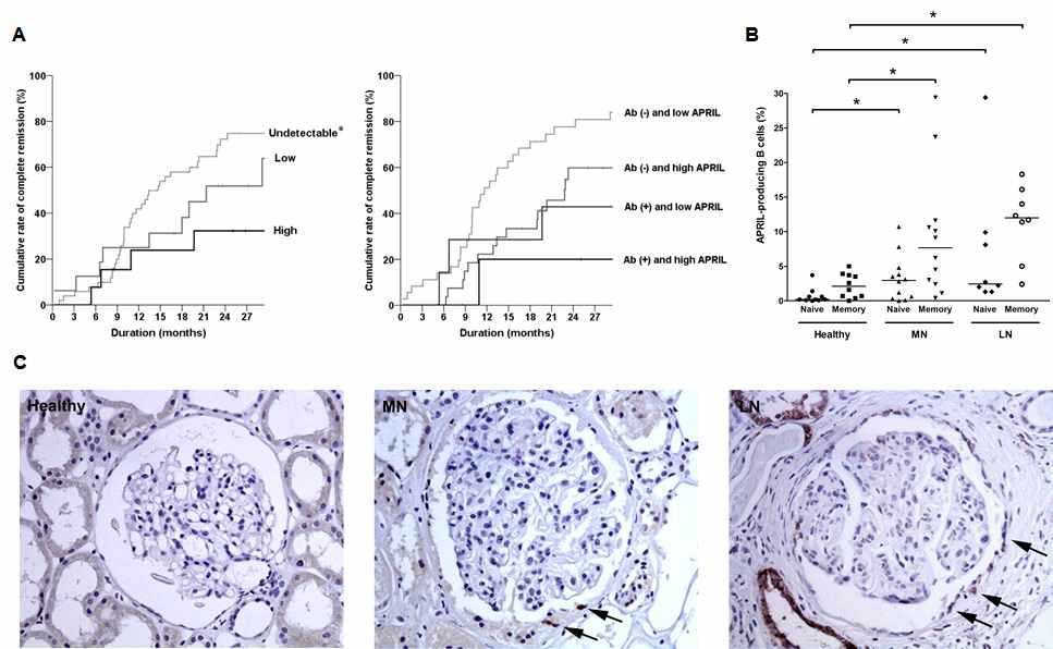 (A) APRIL serum level에 따른 막성사구체신염의 remission. APRIL level이 높은군에서 complete remission이 유의하게 적게 발생함. (B, C) B cell과 PEC에 APRIL의 expression이 막성사구체신염 환자에서 발현 증가함을 확인함