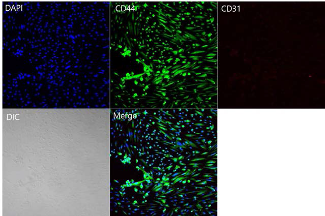 retinoic acid 1uM + FSS 0.5 dyne/cm2 조건에서 48시간 shear stress 시행한 ADSC. 내피세포 표지자인 CD31의 발현에는 실패함