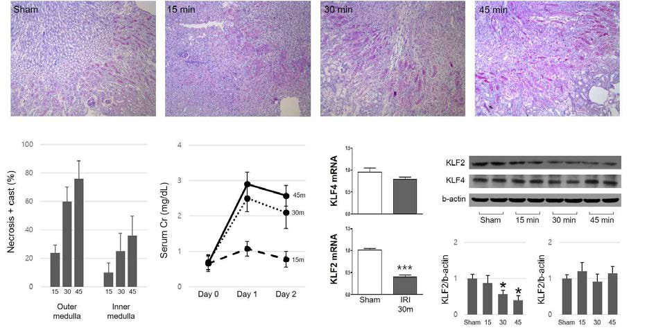 IRI 시간에 따른 조직학 변화, Cr, KLF2, KLF4 qPCR 및 단백 발현