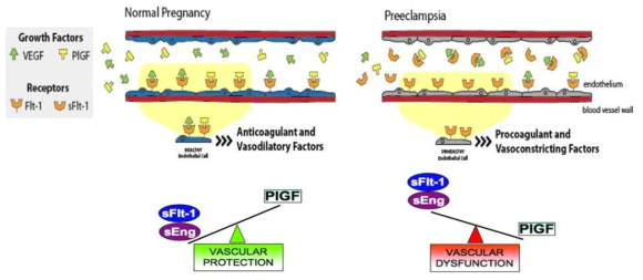 정상 임신부와 임신중독증 환자의 혈관형성 및 억제 단백표지인자의 불균형