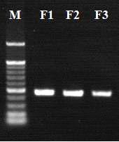 mfa1-1, mfa1-2 그리고 mfa1-3 항원유전자 cloning을 위한 PCR 반응