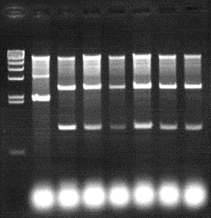 P. gingivalis 53 kDa 단백질의 full size 유전자에 대한 PCR products의 클로닝
