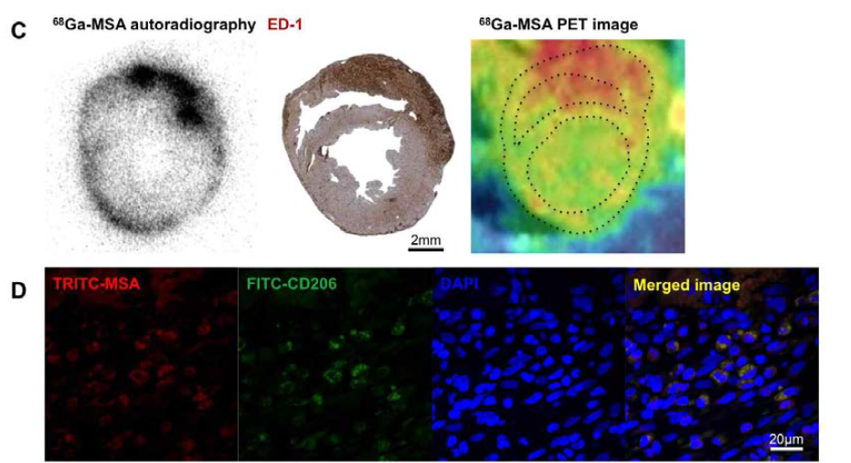 Mannosylated human serum albumin (MSA) 의 분포. (C) 심근염을 유도한 랫드의 심장에서 MSA 는 심근에 염증세포 분포 부위 (ED-1 면역조직화학 염색, 중간) 과 일치하며 이는 PET 을 이용한 영상 (우단) 과도 일치하는 모습임. 좌단, 68Ga-MSA 를 정주한 후 심근에서 68Ga 의 분포를 보기 위한 사후 autoradiography 결과. (D) 공초점 현미경으로 보았을 때, MSA 는 CD206/mannose receptor 양성인 세포 그리고 세포내 분포와 정확히 일치함