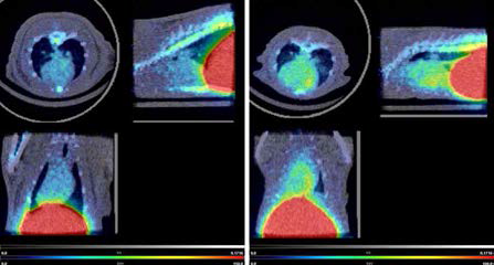 (좌측) 정상, (우측) 심근염 랫드의 68Ga-NOTA-MSA PET 소견. 심근염이 만들어진 랫드에서 68Ga-NOTA-MSA 의 섭취가 유의하게 증가함을 확인함