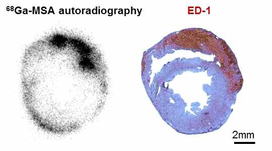 68Ga-NOTA-MSA의 섭취 분포는 대식세포의 형광염색방법인 ED-1에 염색된 세포들의 위치와 일치