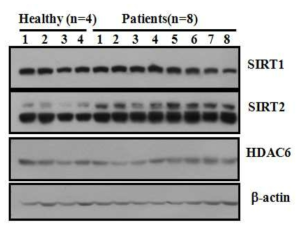 정상군과 환자군의 PBMC에서 SIRT와 HDAC의 발현 패턴 비교.분리된 PBMC를 western blotting으로 확인함. 동량 loading 확인을 위해 b-acting을 사용함