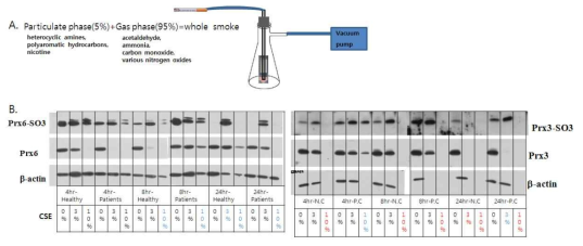 Detection of overoxidized PRDX6 in CSE-exposed PBMCs. (A) CSE를 만들기 위해서 10ml의 medium을 2개 답배를 진공훕입을 이용해 만듬. (B) 배양한 PBMC에 CSE를 농도별로 처라한후 western blotting 함