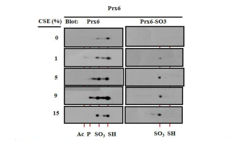 Detection of modified peroxiredoxin in CSE-exposed A549. CSE를 농도별로 처리한 A549 lysate를 2D-PAGE를 수행함