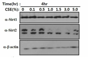 Patterns comparison of PRDX6, HDAC, and SIRT in CSE-exposed A549 cell line.CSE를 A549에 농도별로 처리한 후 다양한 항체를 이용하여 western blotting을 수행함