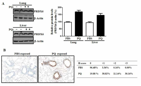 Induction of PRDX6 expression in mouse lung tissue after PQ treatment. (A) PQ 처리된 lung과 liver lysat를 anti-PRDX6로 western blotting해서 발현양을 b-actin을 정량해서 표로 나타냄. (B) PQ처리된 폐조직을 anti-PRDX6로 immunohistochemistry를 수행함