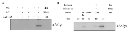 PRDX6의 아세틸화와 탈아세틸화. In vitro HAT assay 에 HDAC or SIRT inhibitors를 처리하여 PRDX6의 아세틸화 변화를 western blotting을 관찰