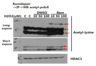 Effect of acetylated RPDX6 by Romidepsin. A549에 romidepsin을 4시간동안 pre-trea한 후, H2O2를 농도별로 24시간 처리한 후 western blotting으로 acetyl-PRDX6발현 패턴 확인